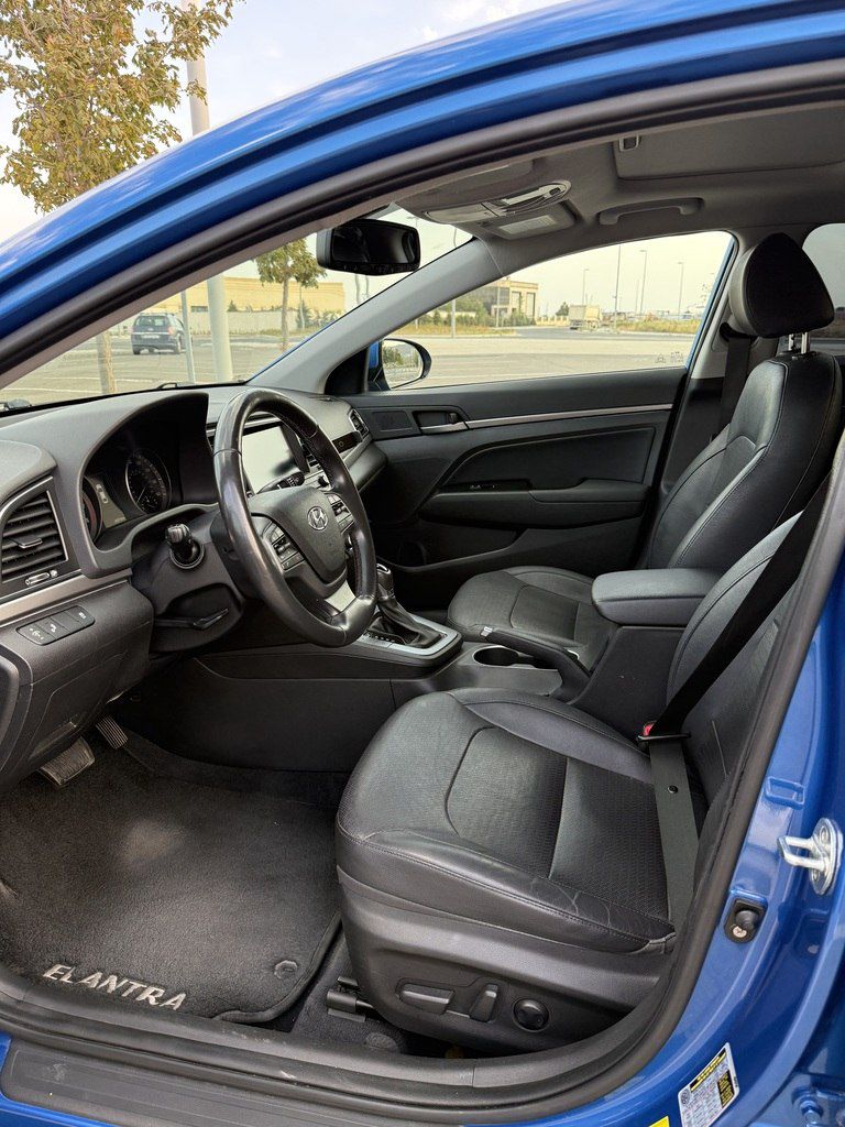 Hyundai Elantra, 2.0 L, 2016 il, 151 278 km — Avtomobillər, Bakı (5)