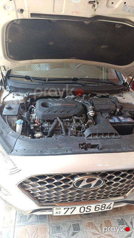 Hyundai Sonata, 2.0 L, 2018 il, 200 000 km — Avtomobillər, Bakı (3)