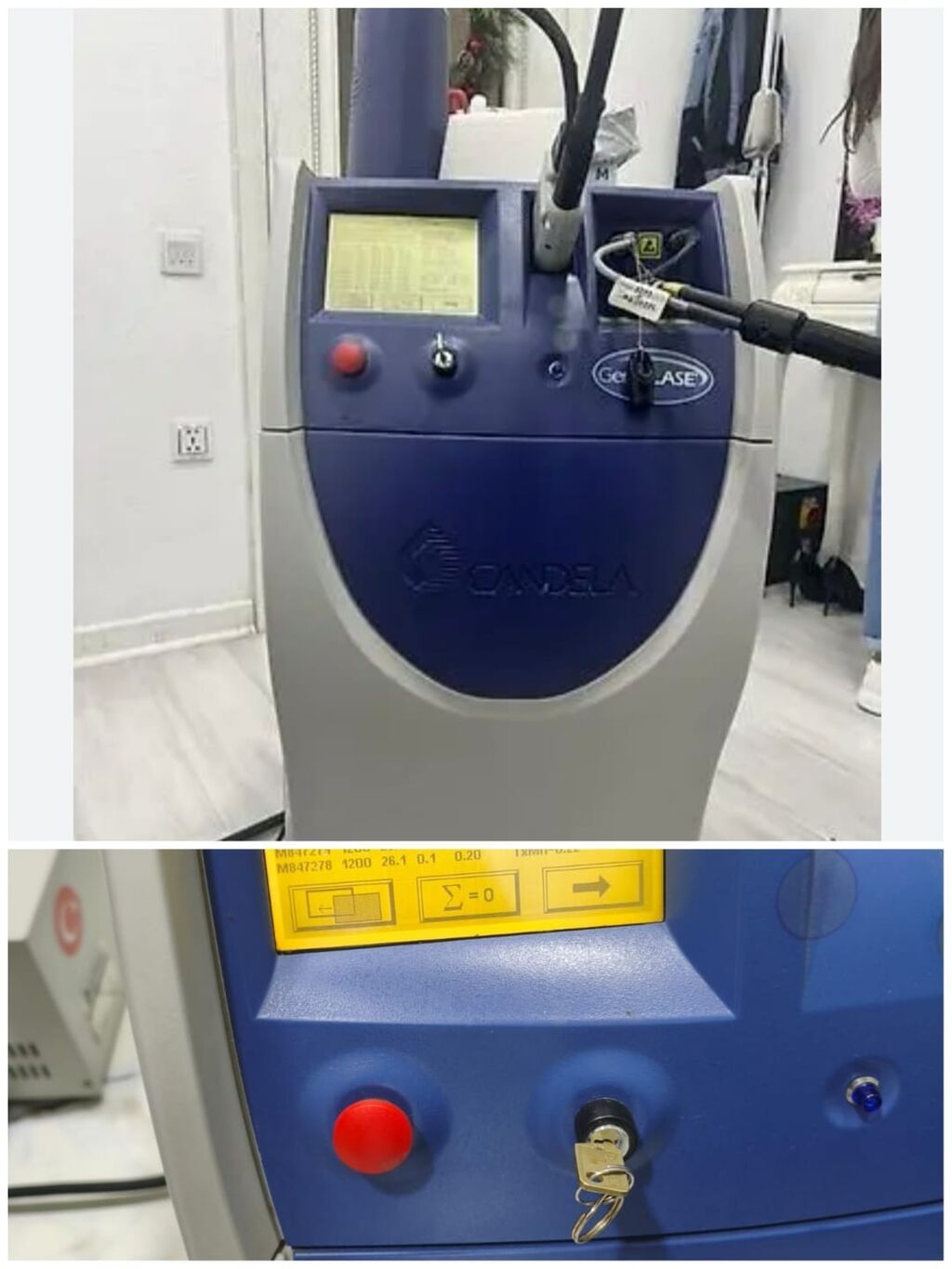 TƏCİLİ SATİLİR!!!! Candela GentleLASE Plus modelinin əsas texniki — Elektronika, Bakı