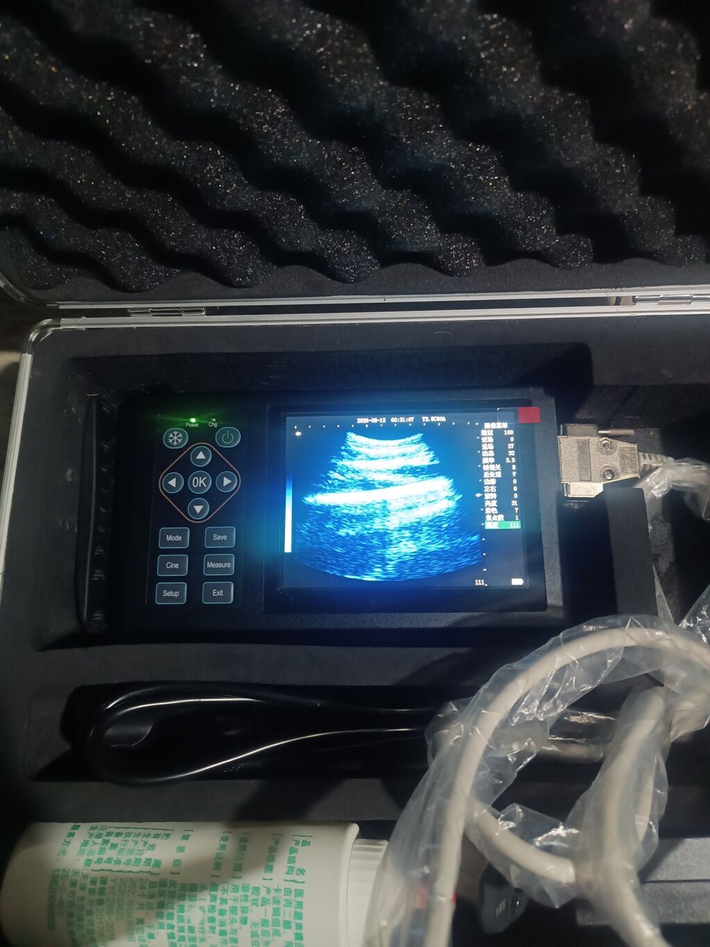 Daşınan ultrasəs diaqnostika cihazı (portable USG) Xüsusiyyətlər — Mallar, Masallı (3)