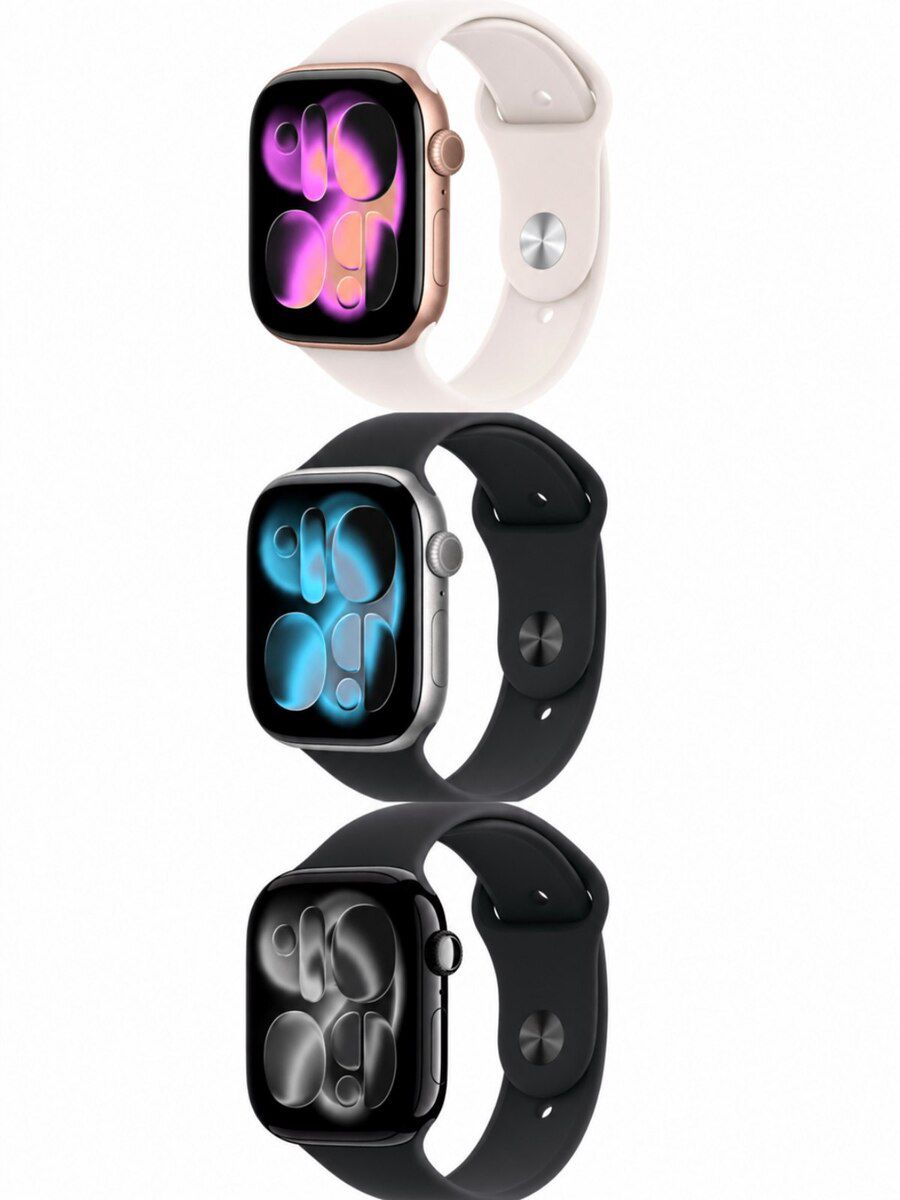 Apple Watch Series 11 Aluminum Jet Black 46mm — Elektronika, Bakı (3)
