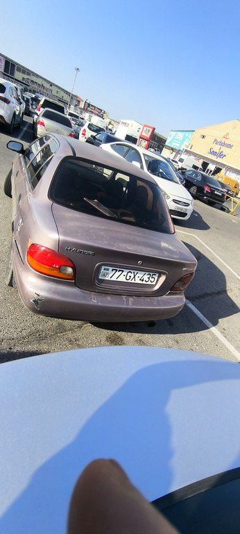 Hyundai Accent, 1.5 L, 1996 il, 317 224 km — Avtomobillər, Bakı (2)