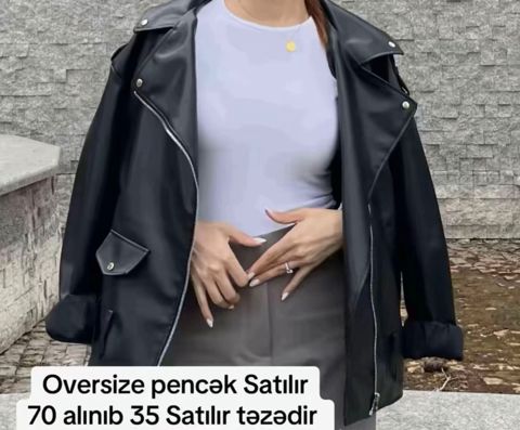Üst geyim — Bakı