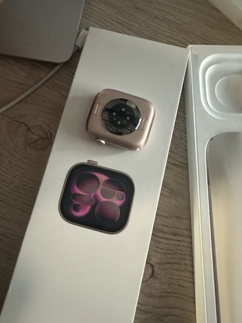Apple Watch Series 11 Aluminum Rose Gold 42mm — Bakı