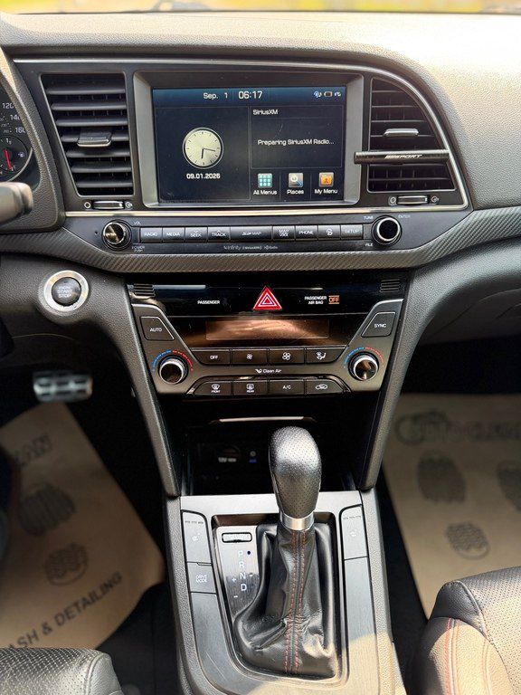 Hyundai Elantra, 1.6 L, 2017 il, 140 000 km — Avtomobillər, Bakı (12)
