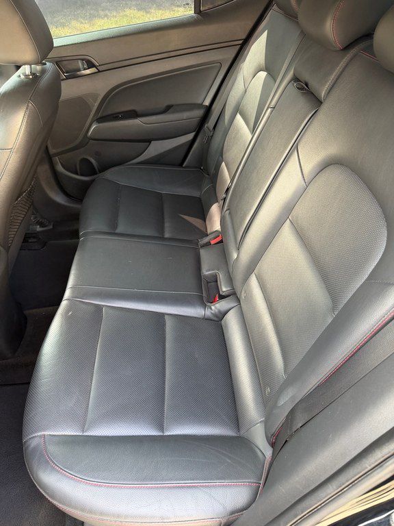 Hyundai Elantra, 1.6 L, 2017 il, 140 000 km — Avtomobillər, Bakı (10)