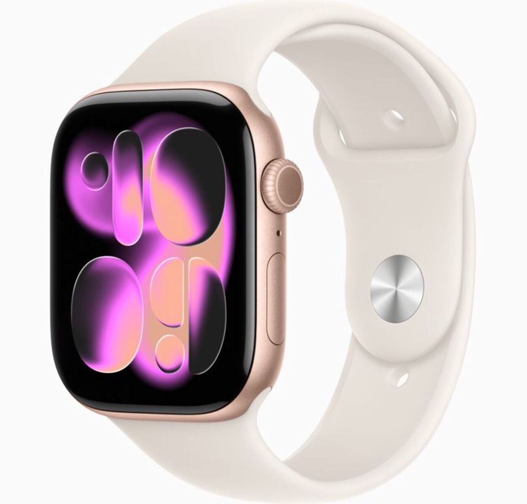 Apple Watch Series 11 Aluminum Rose Gold 46mm — Ağıllı saatlar və biləkliklər, Bakı (2)