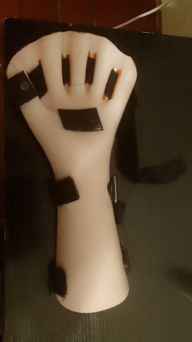 Ortozlar, bilək və əl üçün Şina-Splint — Gözəllik və səhiyyə, Bakı (3)