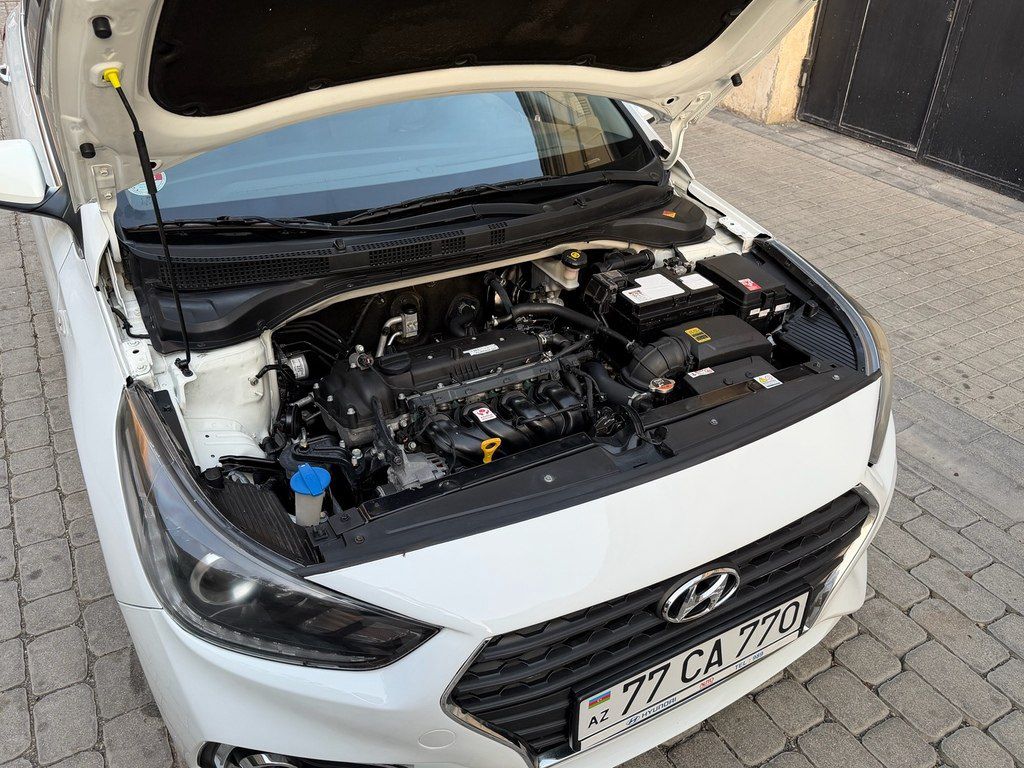 Hyundai Accent, 1.6 L, 2018 il, 126 000 km — Avtomobillər, Bakı (11)