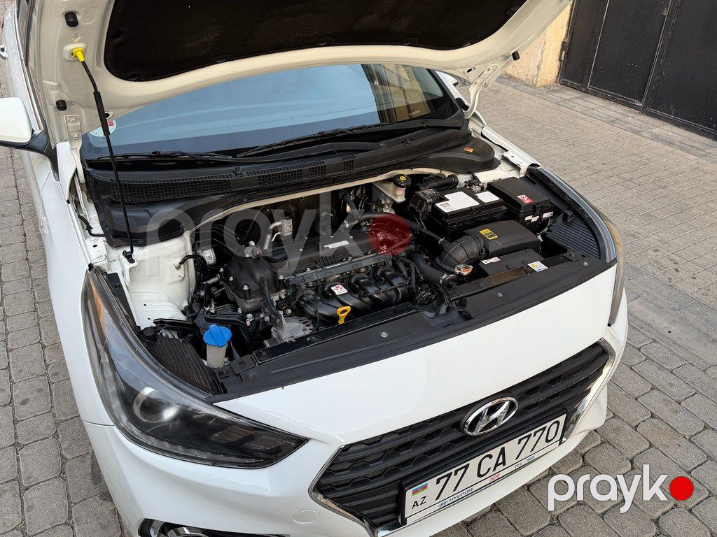 Hyundai Accent, 1.6 L, 2018 il, 126 000 km — Avtomobillər, Bakı (11)