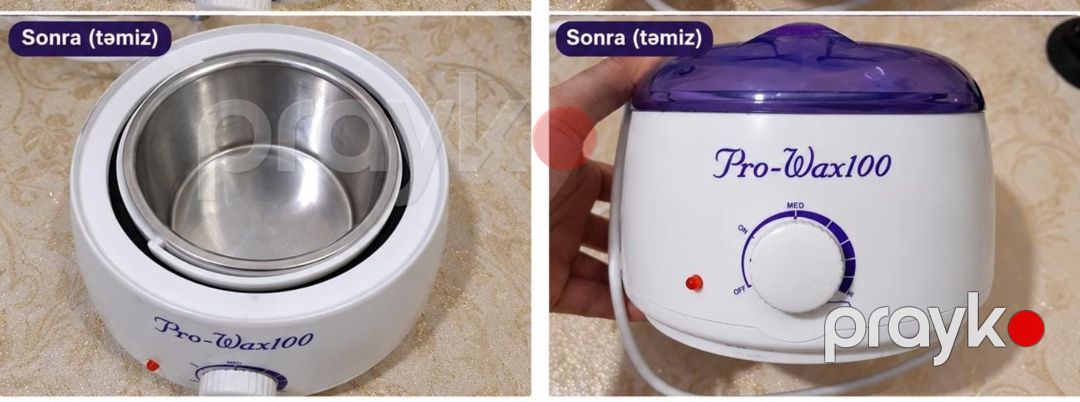 Depilyasiya üçün mum aparatı — Gözəllik və səhiyyə, Bakı