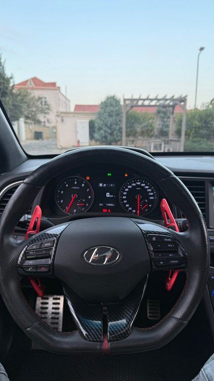 Hyundai Avante, 1.6 L, 2017 il, 114 000 km — Avtomobillər, Bakı (8)