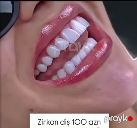Zirkon Emax
