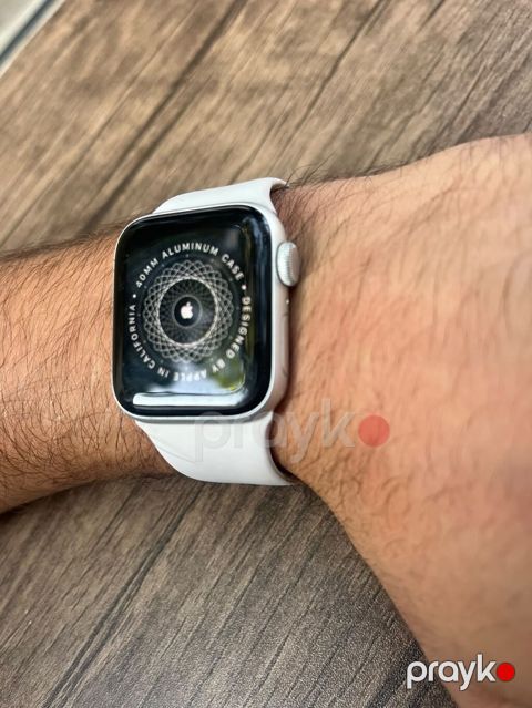 Məhsul: Apple Watch Series se hec bir problemi yoxdur icloudadir — Bakı