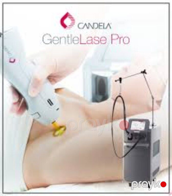 Lazer epilyasiya aparatı "Alexandrite Candella Gentlease Pro U 2024" — Biznes və avadanlıq, Bakı (2)