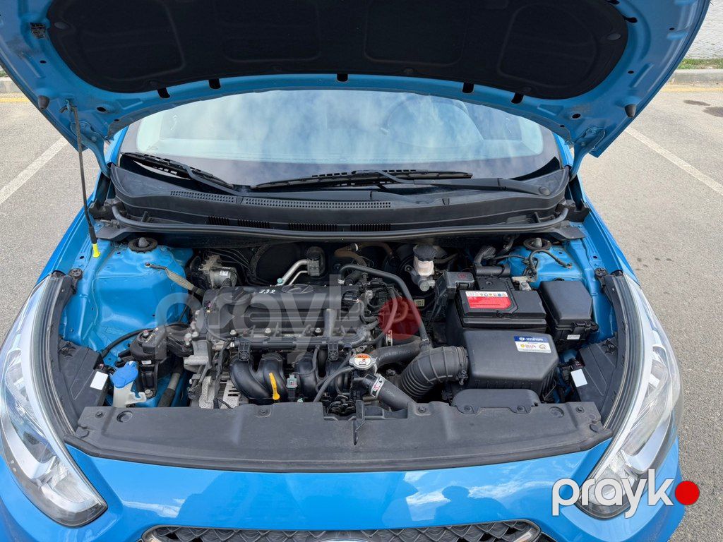 Hyundai Accent, 1.4 L, 2017 il, 75 100 km — Avtomobillər, Bakı (10)