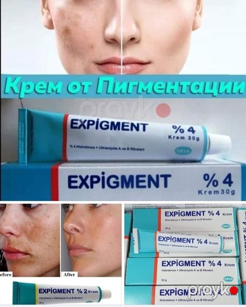 "Expigment" ləkələrə qarşı krem — Bakı
