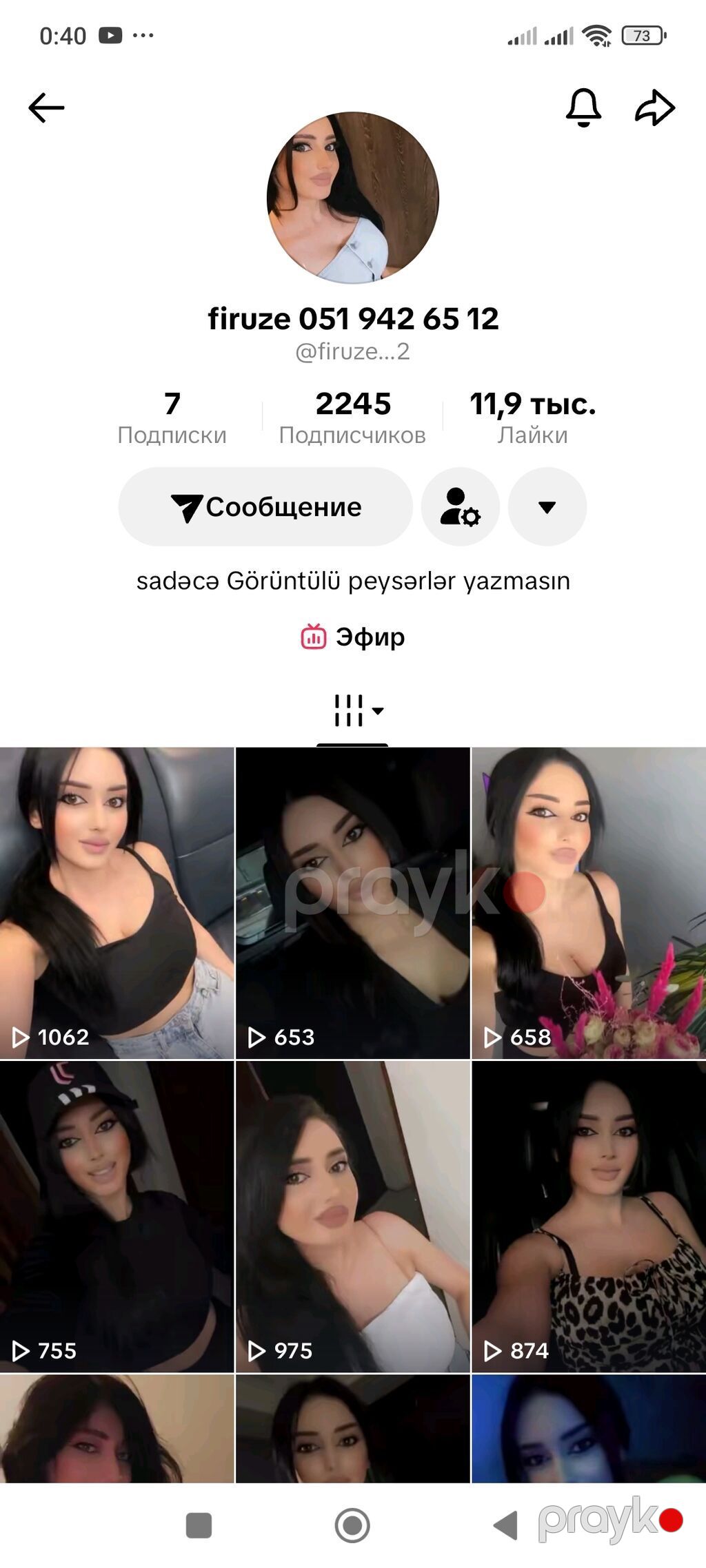 Üzük, Əqiq — Üzüklər, Bakı (4)