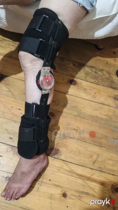 Tənzimlənən diz-ayaq ortezi - Diz və baldır üçün sərt dayaqlı — Bakı