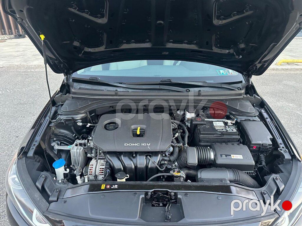 Hyundai Elantra, 2.0 L, 2016 il, 149 669 km — Avtomobillər, Bakı (9)