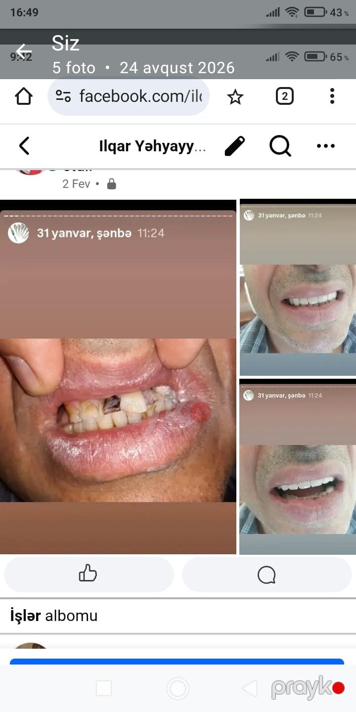 Stomatoloq işi axtarıram — İş axtarıram, Sumqayıt (3)