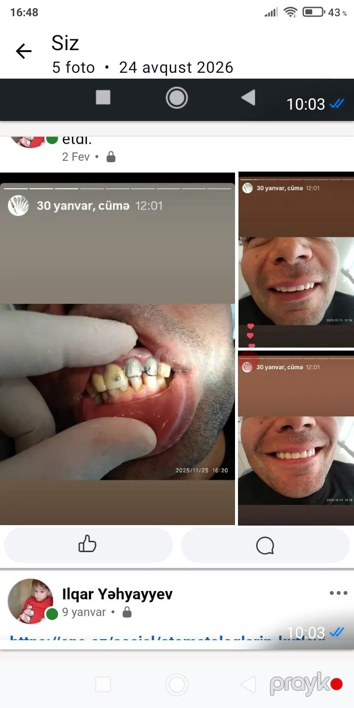 Stomatoloq işi axtarıram — İş axtarıram, Sumqayıt (6)