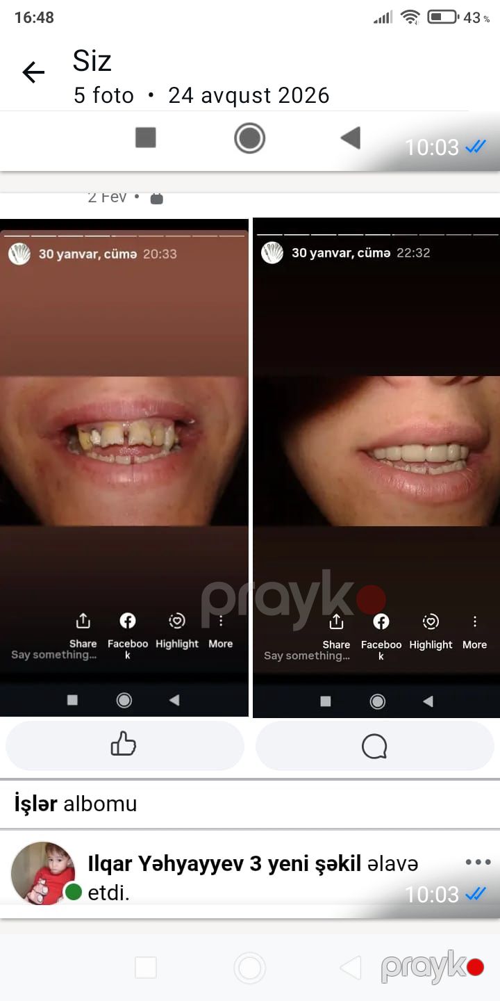 Stomatoloq işi axtarıram — İş axtarıram, Sumqayıt (7)