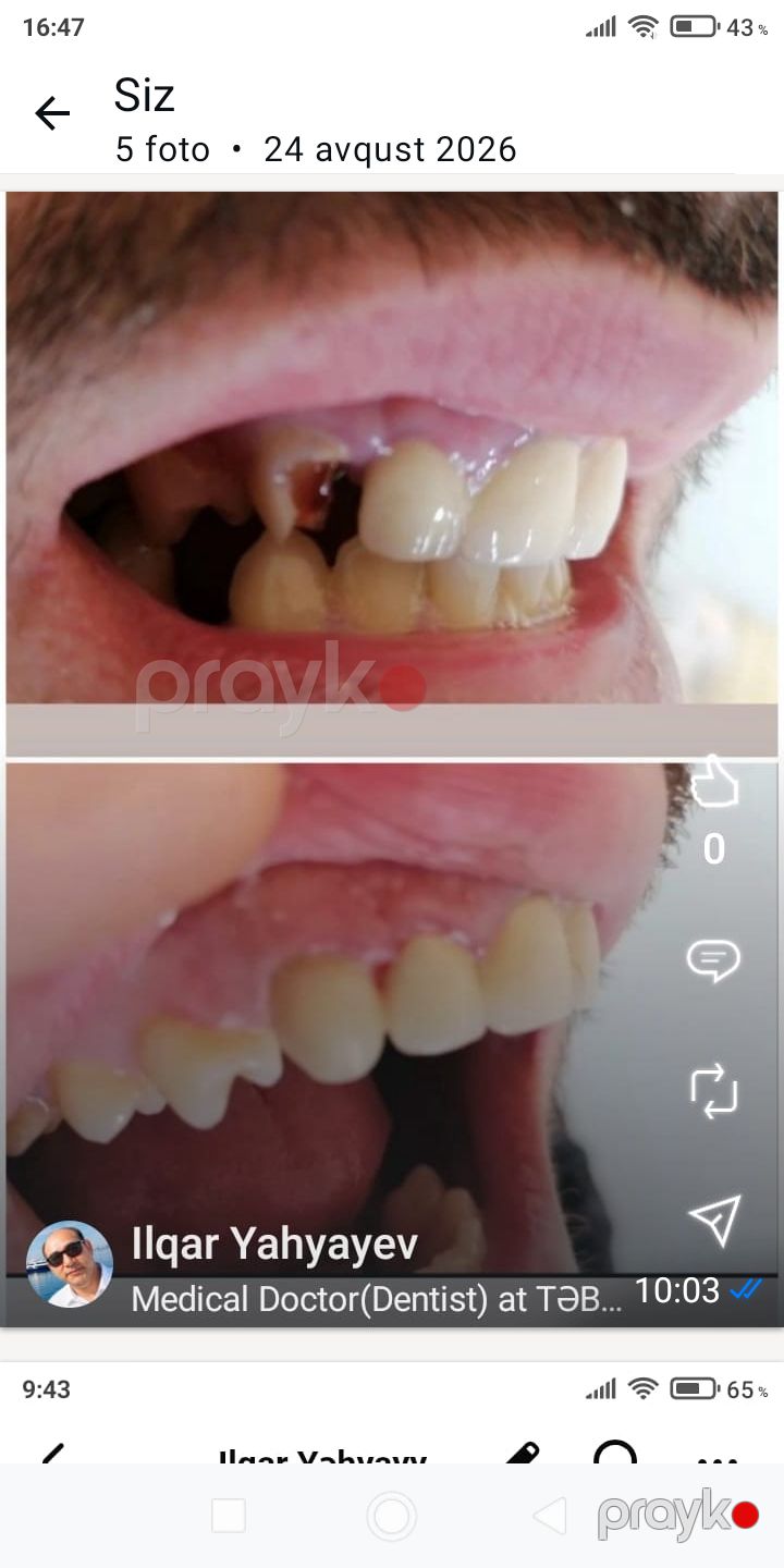 Stomatoloq işi axtarıram — İş axtarıram, Sumqayıt (5)