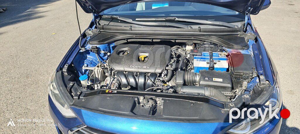 Hyundai Elantra, 2.0 L, 2017 il, 107 454 km — Avtomobillər, Bakı (10)