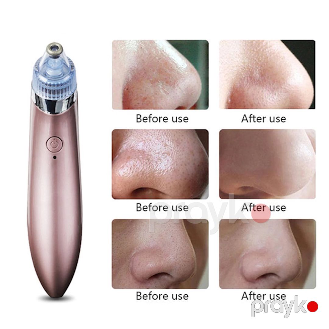 Vakuum üz təmizləyici aparatı Menqshahayd Beauty Skin Care Expert XN-8030 — Qayğı texnikası və aksesuarları, Bakı (3)