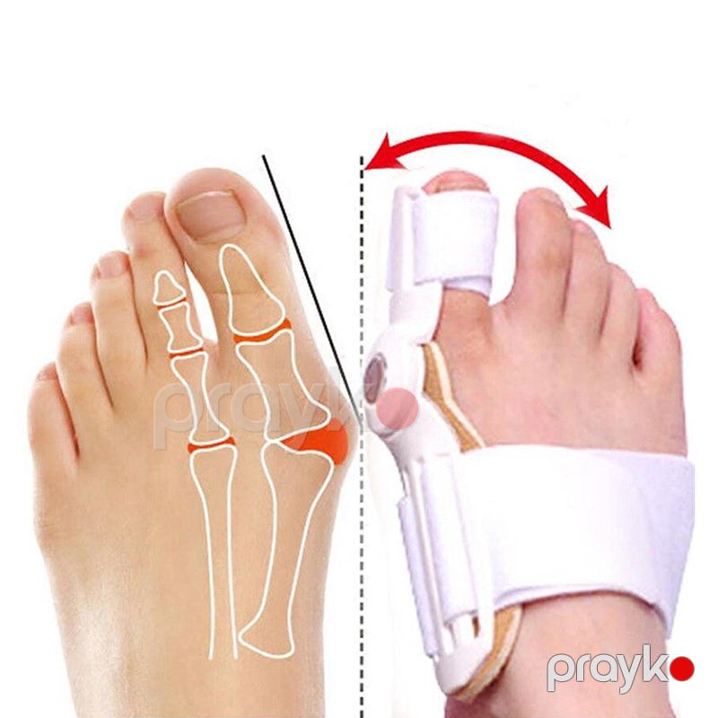 2 Ədəd Bunion Korrektoru – Hallux Valgus Üçün Professional Ayaq Barmağı Düzləşdirici Şin — Ev texnikası, Bakı (4)