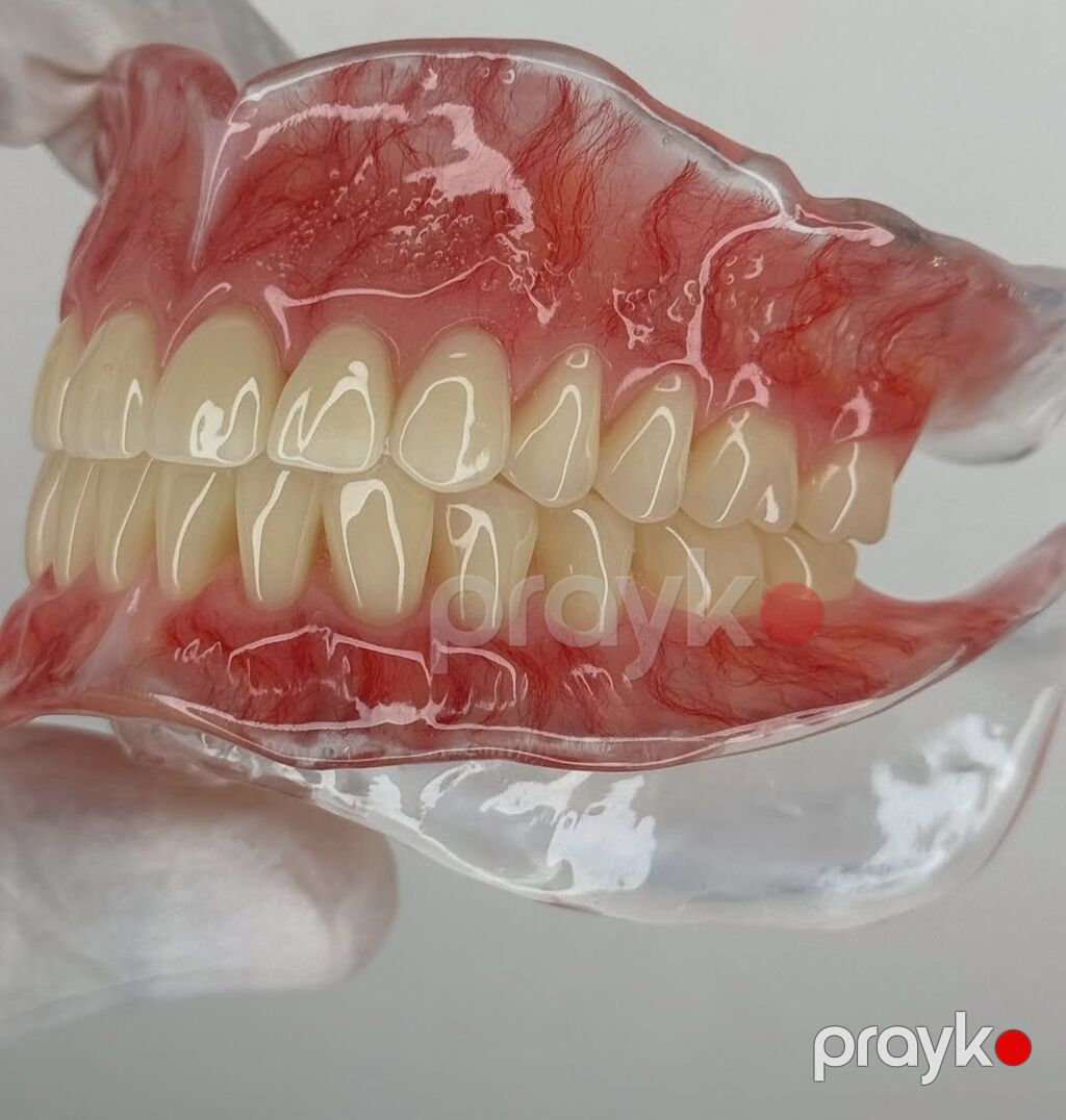 Tam üst-alt protez dəsti – anatomik detallı, yüksək estetikalı — Xidmətlər, Bakı (2)