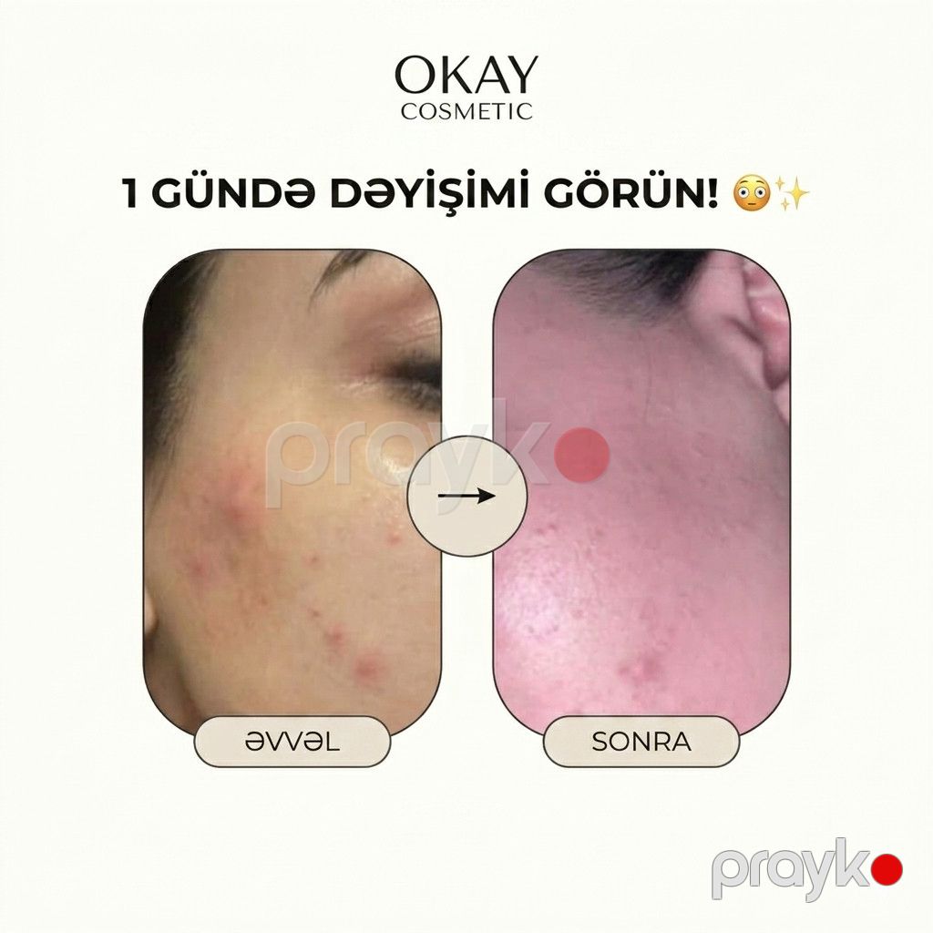 Sızanaq əleyhinə balanslaşdırıcı krem Okay Cosmetic Anti-Acne 30 ml — Mallar, Bakı (3)