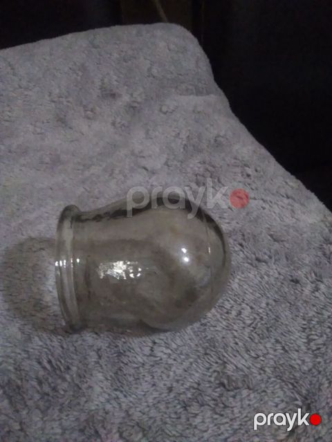 Şüşə bankalar – hicama/ventuz terapiyası üçün - Material: qalın — Bakı