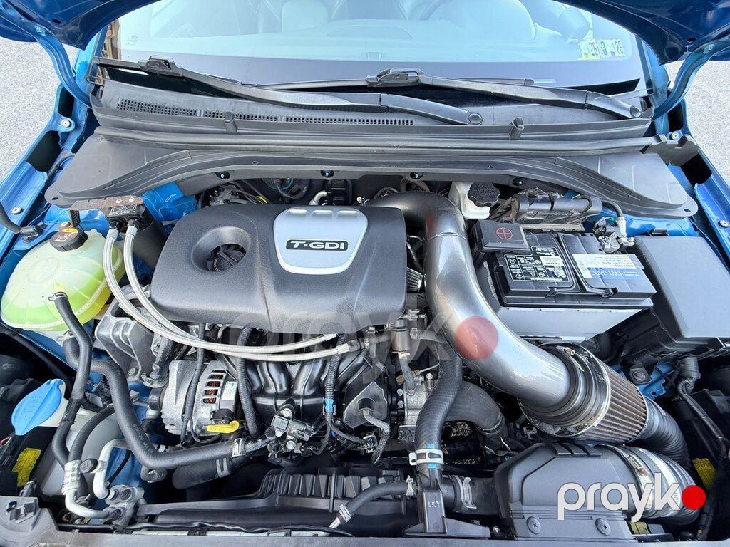 Hyundai Elantra, 1.6 L, 2017 il, 166 600 km — Avtomobillər, Bakı (9)