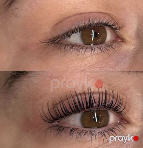 Kiprik laminasiyası, botoks boya — Bakı