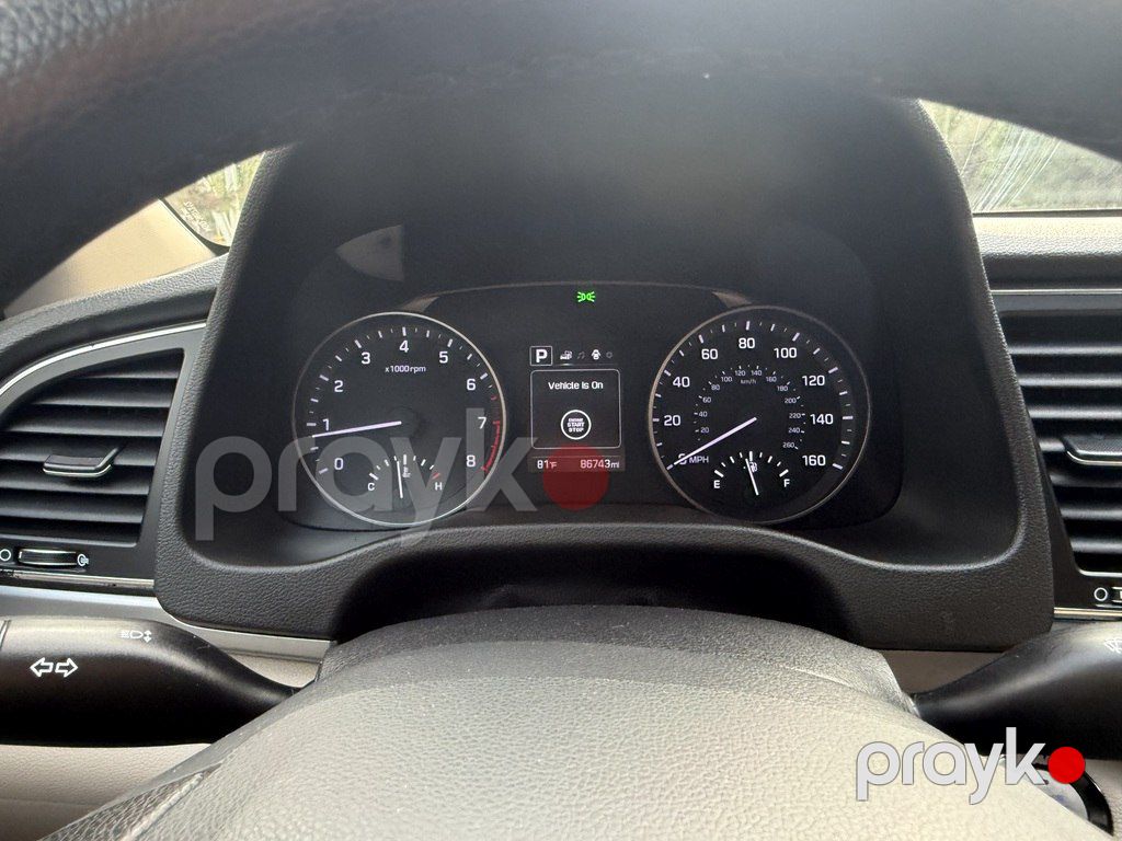 Hyundai Elantra, 2.0 L, 2016 il, 139 599 km — Avtomobillər, Masallı (10)