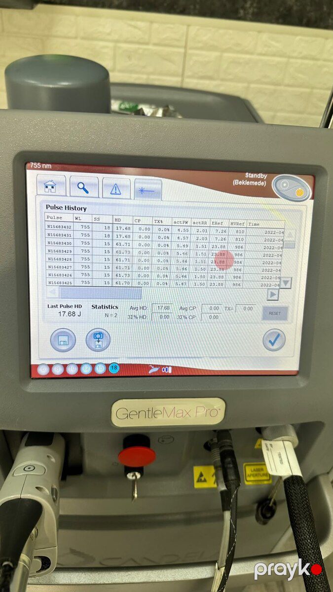 Lazer epilyasiya aparatı — Biznes və avadanlıq, Bakı (6)