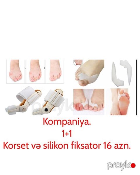 Böyük barmaq üçün fiksator — Bakı