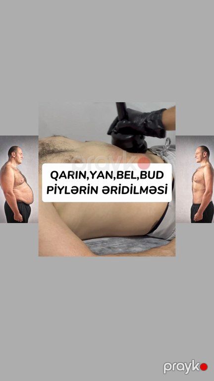 Vibro masaj xidməti — Digər, Bakı (2)