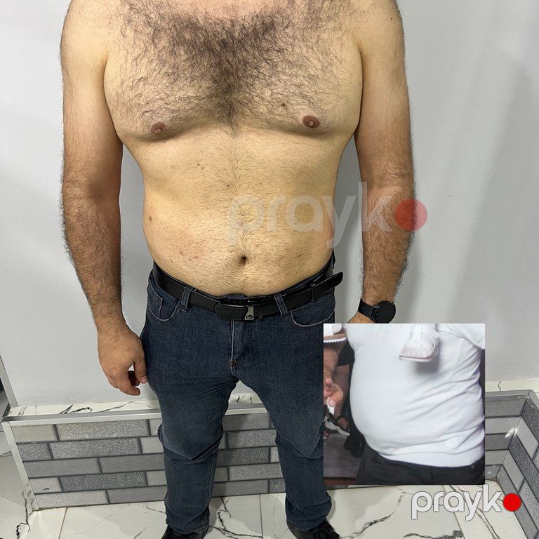 Vibro masaj xidməti — Digər, Bakı (9)