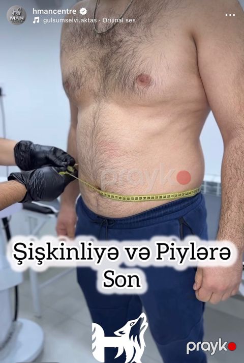 Vibro masaj xidməti — Bakı