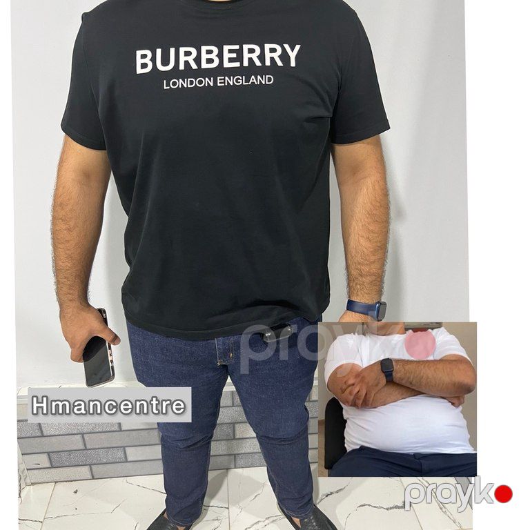 Vibro masaj xidməti — Digər, Bakı (7)