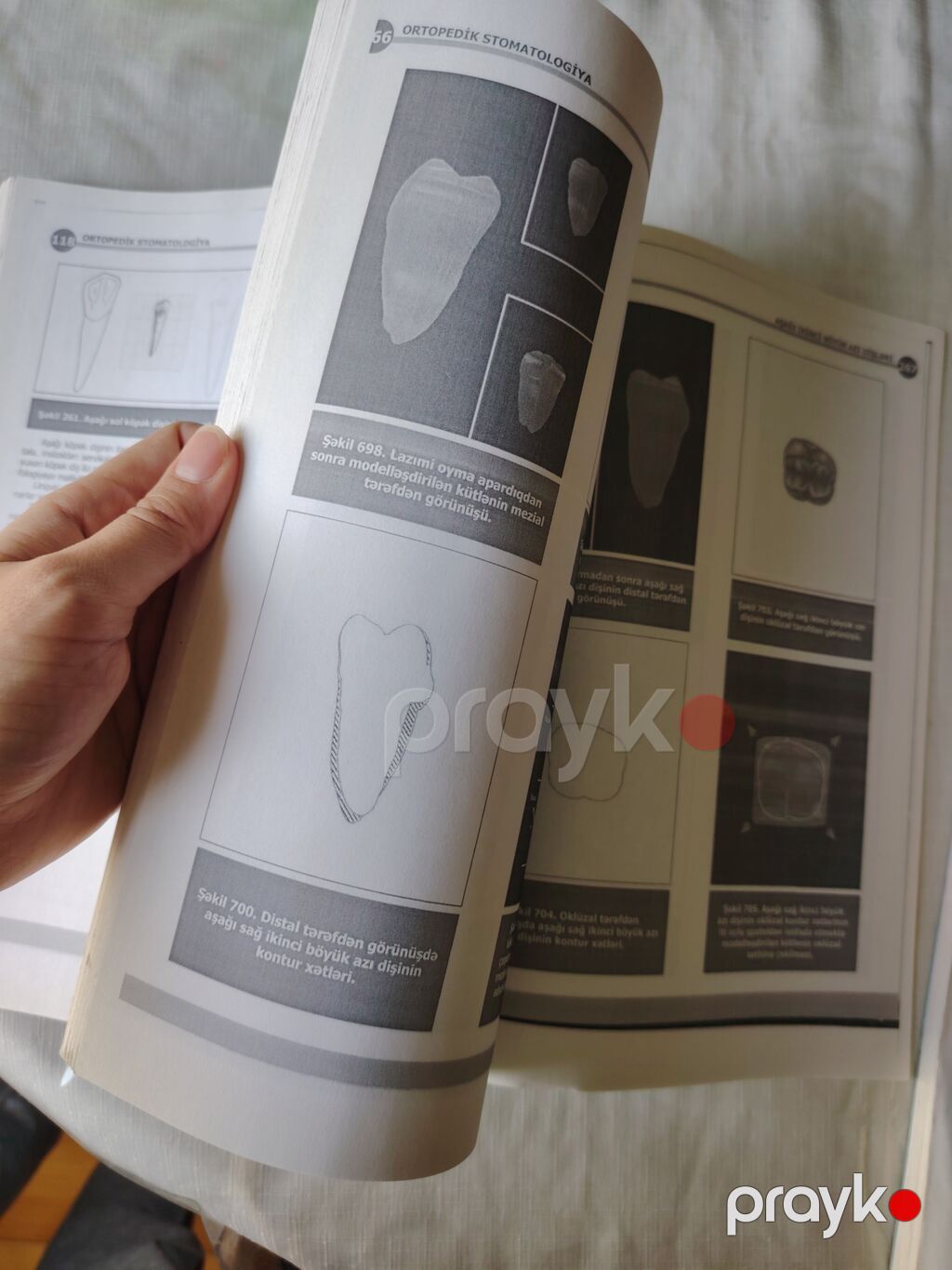 Məhsul: “Ortopedik stomatologiya: Dişlərin morfologiyası və oyma — Kitablar, Bakı (2)
