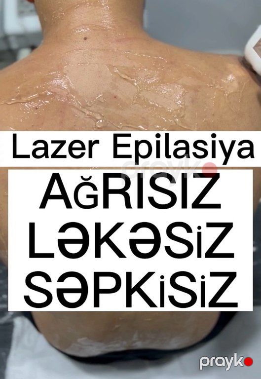 Kişilər üçün lazer epilyasiyası xidməti — Digər, Bakı (4)