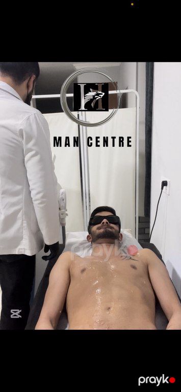 Kişilər üçün lazer epilyasiyası xidməti — Digər, Bakı (5)