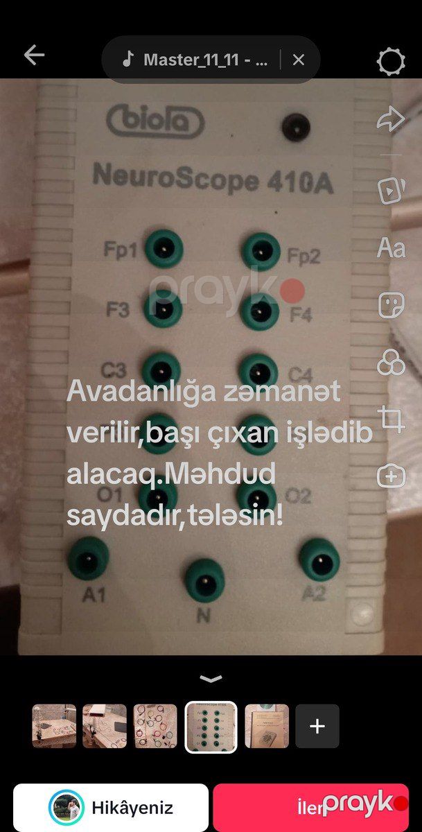 Elektroensefaloqraf — Biznes və avadanlıq, Bakı (2)