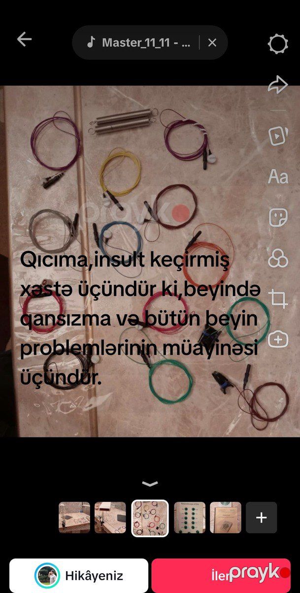 Elektroensefaloqraf — Biznes və avadanlıq, Bakı (3)
