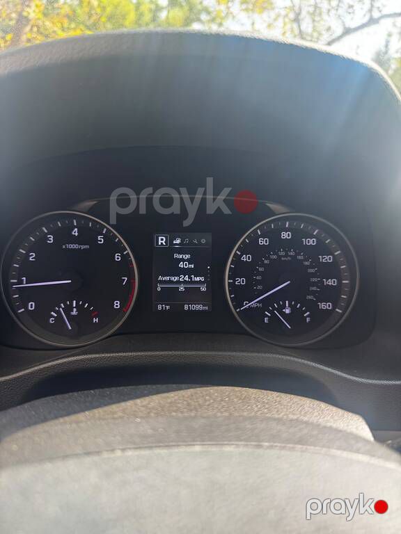Hyundai Elantra, 2.0 L, 2017 il, 130 516 km — Avtomobillər, Bakı (10)