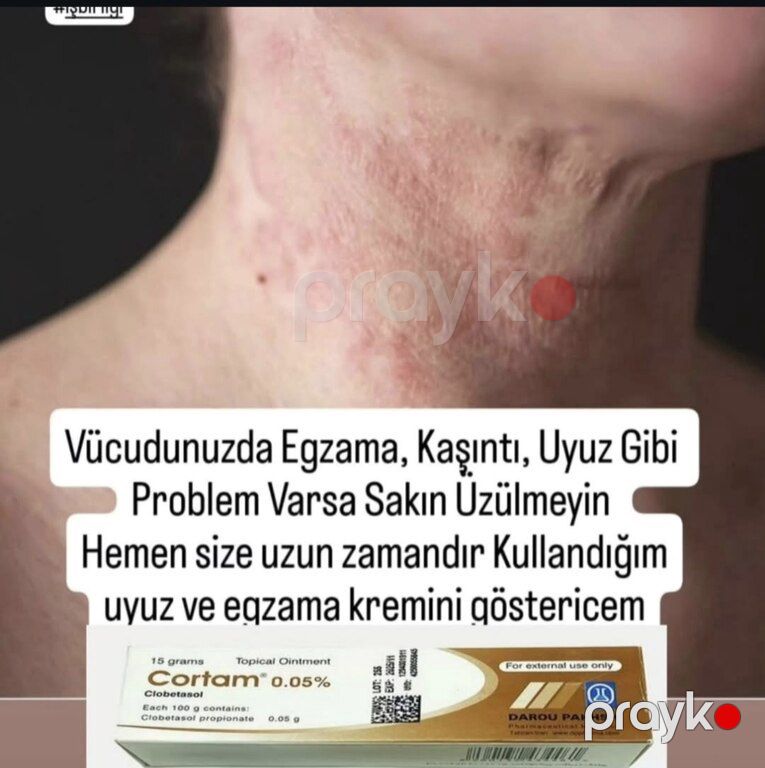 "Cotam" göbələk əleyhinə maz — Gözəllik və səhiyyə, Bakı (6)